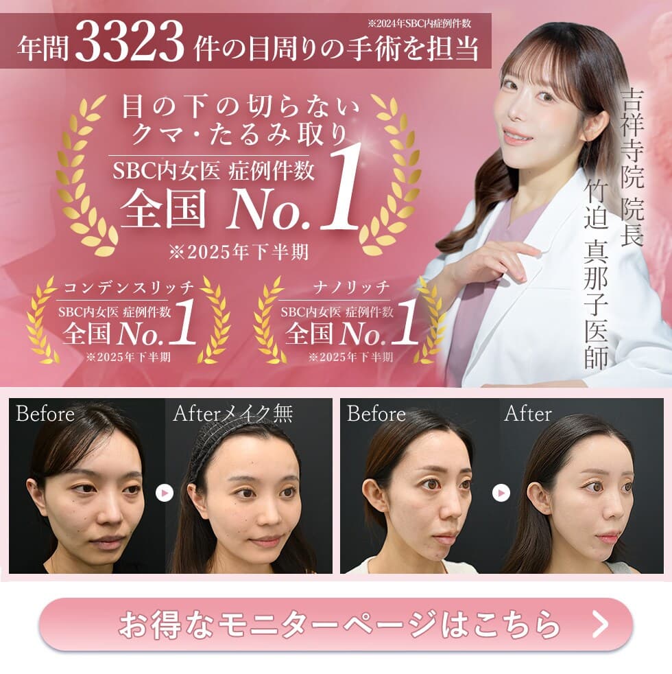 目の下の切らないクマ・たるみ取り、脂肪注入、裏ハムラ、切開ハムラ、表ハムラ、アイバックリムーブ、クマ取り