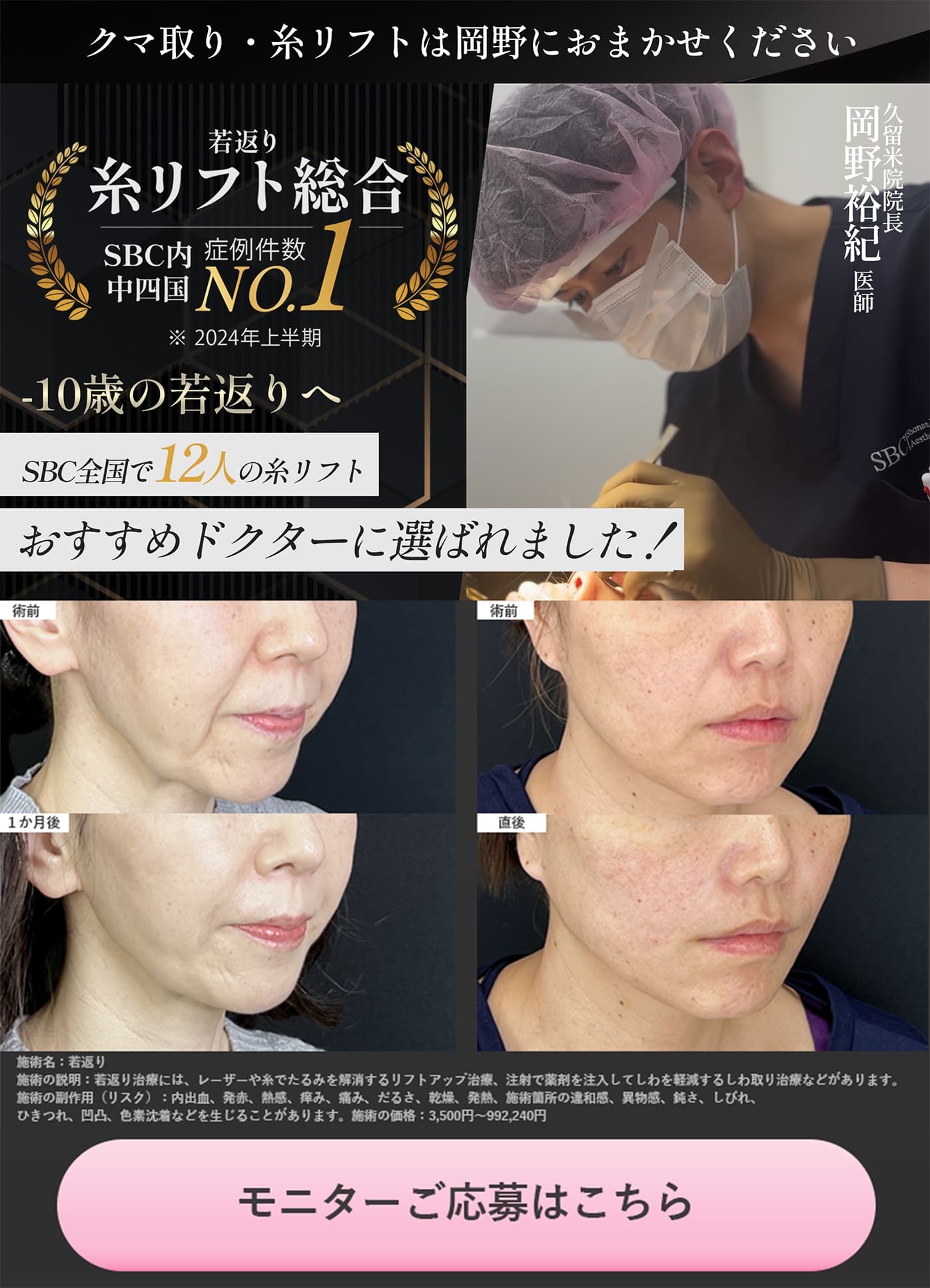 小顔で変わる『これから』 愛され小顔術