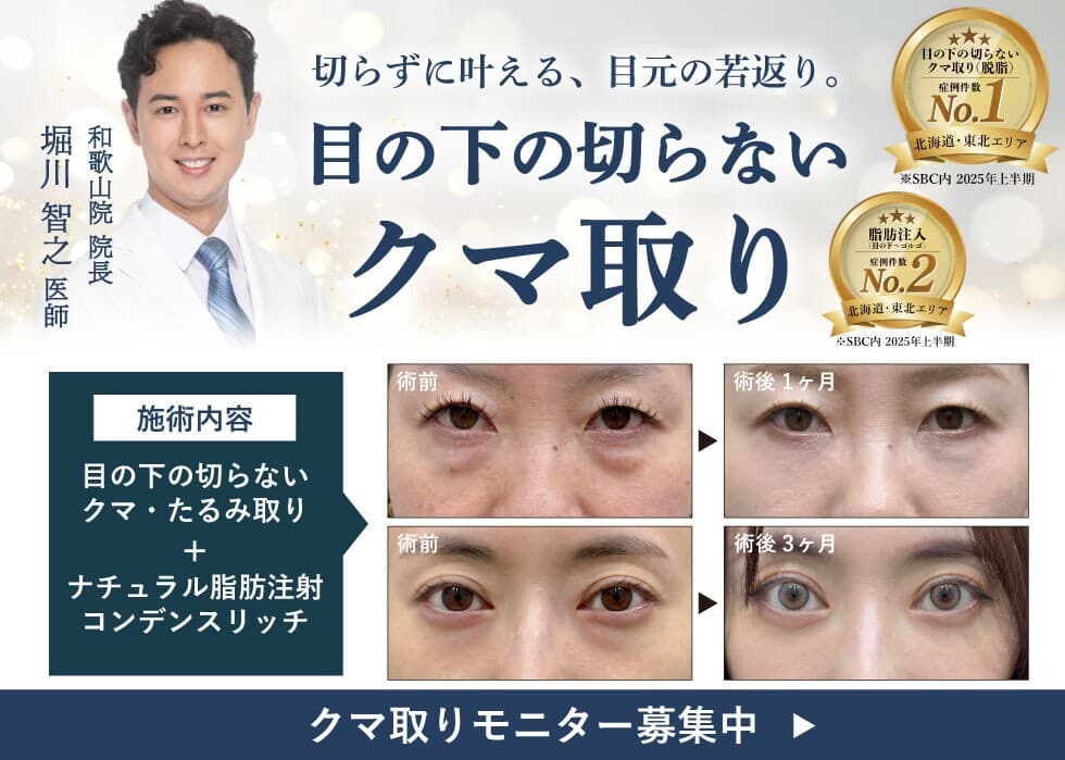 詳細はこちら