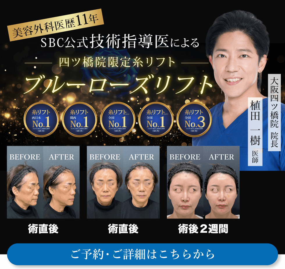 【SBCグループ内では大阪四ツ橋院のみ】全国技術指導医 植田 一樹院長が執刀する最高峰の糸リフト「 ブルーローズリフト 」
