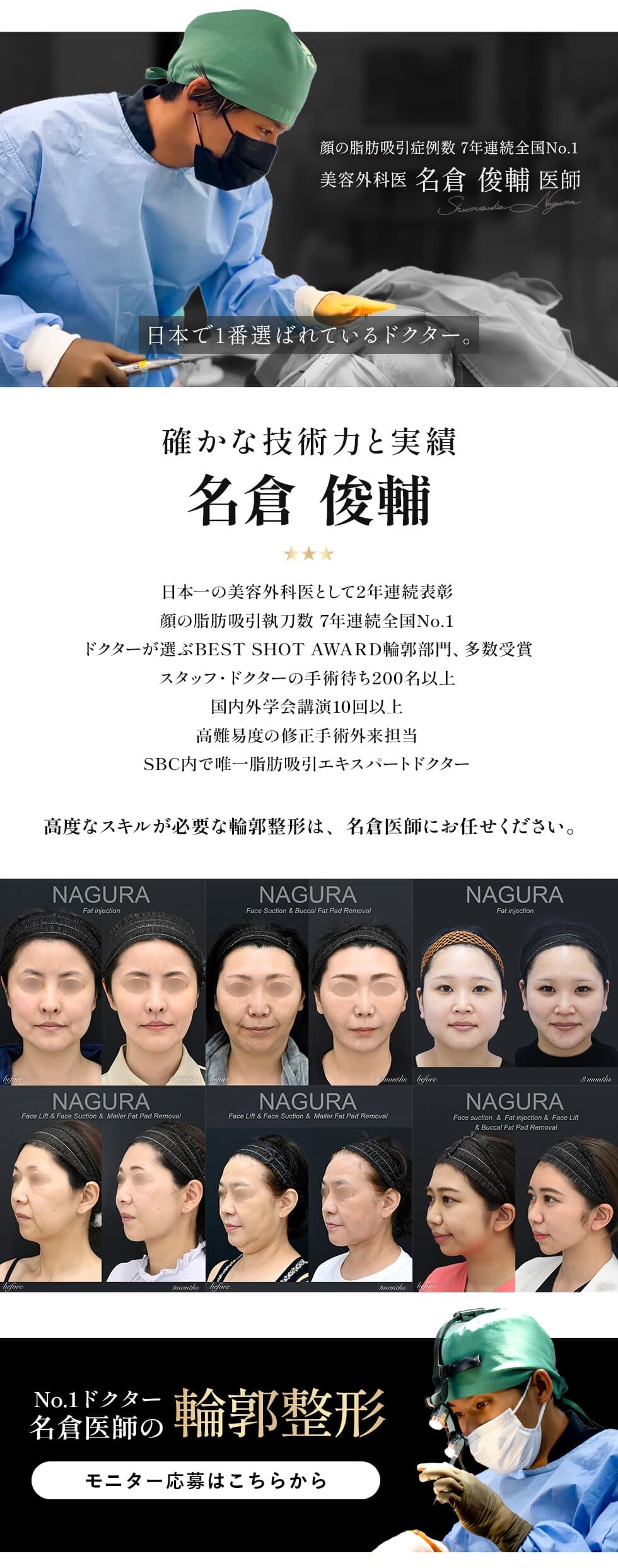「なりたい」が、かなう。症例数全国No.1ドクターの輪郭形成術